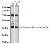 Adenosine Deaminase (ADA) Rabbit pAb (A13910)