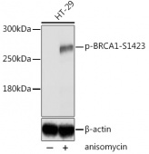 Phospho-BRCA1-S1423 Rabbit pAb (AP0232)