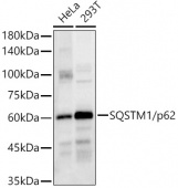 [KO Validated] SQSTM1/p62 Rabbit pAb (A11250)